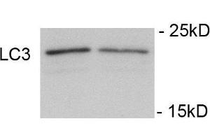 Immunoblots of SH-SY5Y cells treated with rapamycin for 1 h was probed with (ABIN389699 and ABIN2839660). (LC3C antibody  (pSer12))