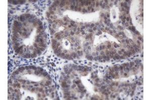 Image no. 2 for anti-Adrenocortical Dysplasia Homolog (ACD) antibody (ABIN1496406) (ACD antibody)