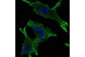 Immunofluorescence analysis of U251 cells using JUP mouse mAb (green). (JUP antibody)