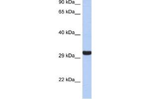 Granzyme K antibody used at 1 ug/ml to detect target protein. (GZMK antibody)