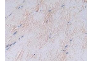 Immunohistochemistry (IHC) image for anti-Syndecan 1 (SDC1) (AA 58-313) antibody (ABIN7434422)