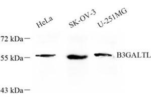 Western blot analysis of B3GALTL (ABIN7073206) at dilution of 1: 600 (B3GALTL antibody)