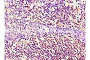 Immunohistochemistry of paraffin-embedded human tonsil tissue using ABIN7161178 at dilution of 1:100 (Nestin antibody)