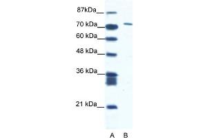 WB Suggested Anti-CXORF6 Antibody Titration:  1. (MAMLD1 antibody  (N-Term))