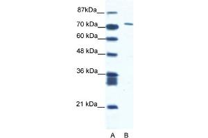 WB Suggested Anti-CXORF6 Antibody Titration:  1.