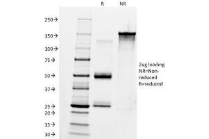 SDS-PAGE Analysis of Purified, BSA-Free Anti-IgM Antibody (clone IM260). (Mouse anti-Human IgM Antibody)