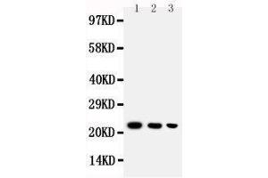 Anti-BAFF antibody, Western blotting Lane 1: Recombinant Human BAFF Protein 10ng Lane 2: Recombinant Human BAFF Protein 5ng Lane 3: Recombinant Human BAFF Protein 2. (BAFF antibody  (C-Term))