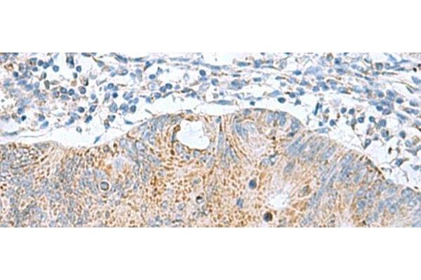 GCSH antibody