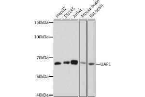 Western blot analysis of extracts of various cell lines, using U Rabbit mAb (ABIN7271211) at 1:1000 dilution. (UAP1 antibody)