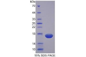 SDS-PAGE (SDS) image for Natural Cytotoxicity Triggering Receptor 3 (NCR3) (AA 21-147) protein (His tag) (ABIN6238885) (NCR3 Protein (AA 21-147) (His tag))