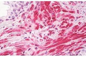 Image no. 2 for anti-Zinc Finger, CCHC Domain Containing 11 (ZCCHC11) (AA 1403-1452) antibody (ABIN6749768) (ZCCHC11 antibody  (AA 1403-1452))