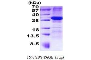 SDS-PAGE (SDS) image for Armadillo Repeat Containing 10 (ARMC10) (AA 28-308) protein (His tag) (ABIN7529236)