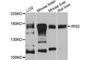 Western blot analysis of extracts of various cells, using IRS2 antibody. (IRS2 antibody)