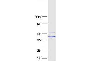 Validation with Western Blot (CA7 Protein (Transcript Variant 2) (Myc-DYKDDDDK Tag))