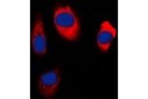 Immunofluorescent analysis of EDG5 staining in Hela cells. (S1PR2 antibody  (C-Term))