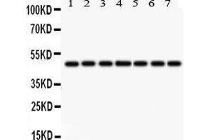 Western Blotting (WB) image for anti-Isocitrate Dehydrogenase 1 (NADP+), Soluble (IDH1) (AA 381-413), (C-Term) antibody (ABIN3043855) (IDH1 antibody  (C-Term))