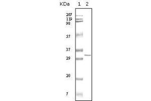 Western blot analysis using HPTR mouse mAb against truncated HPRT recombinant protein. (HPRT1 antibody)