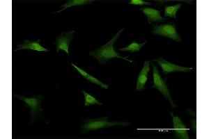 Immunofluorescence of purified MaxPab antibody to BIRC5 on HeLa cell.