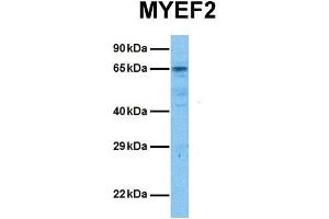 Host:  Rabbit  Target Name:  MYEF2  Sample Tissue:  Human 786-0  Antibody Dilution:  1.