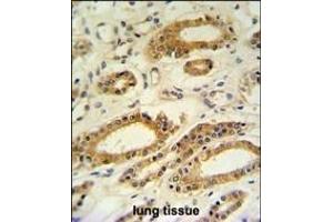 DDO Antibody (Center) (ABIN650991 and ABIN2840026) IHC analysis in formalin fixed and paraffin embedded lung tissue followed by peroxidase conjugation of the secondary antibody and DAB staining. (DDO antibody  (AA 102-130))