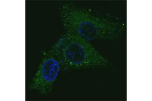 Fluorescent confocal image of HepG2 cells stained with MET antibody. (c-MET antibody  (Catalytic Domain))