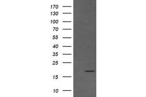 Image no. 1 for anti-Cancer/testis Antigen 1B (CTAG1B) antibody (ABIN1499907) (CTAG1B antibody)