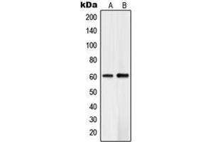 Western blot analysis of PLK5 expression in Jurkat (A), human brain (B) whole cell lysates.