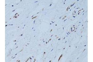 Immunohistochemistry of paraffin-embedded human breast using SELE Antibody. (Selectin E/CD62e antibody  (AA 22-230))