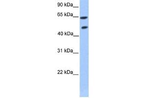 Transfected 293T; WB Suggested Anti-ZNF449 Antibody Titration: 0. (ZNF449 antibody  (Middle Region))