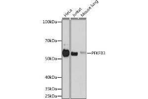 Western blot analysis of extracts of various cell lines, using PFKFB3 Rabbit mAb (ABIN1680620, ABIN3018306, ABIN3018307 and ABIN7101590) at 1:500 dilution. (PFKFB3 antibody)