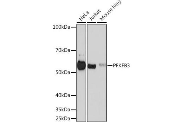 PFKFB3 抗体