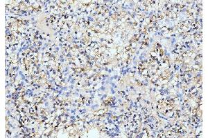 IHC analysis of ITCH/AIP4 using anti-ITCH/AIP4 antibody (ABIN7600263). (ITCH antibody  (AA 17-358))