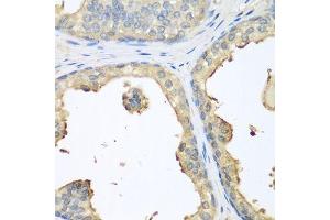 Immunohistochemistry of paraffin-embedded human prostate using GPI antibody. (GPI antibody  (AA 1-280))