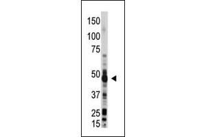 The anti-OAS1 Pab (ABIN390164 and ABIN2840661) is used in Western blot to detect OAS1 in mouse liver lysate. (OAS1 antibody  (C-Term))