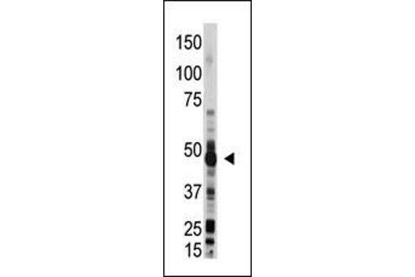 OAS1 antibody  (C-Term)