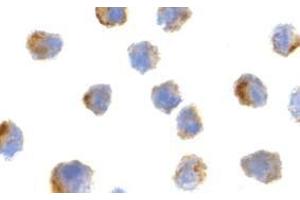 Immunocytochemistry of Bit1 in 3T3 cells with AP30152PU-N Bit1 antibody at 2 μg/ml. (PTRH2 antibody  (N-Term))