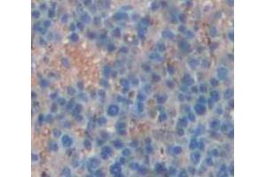 IHC-P analysis of Human Tissue, with DAB staining. (QPCT antibody  (AA 29-361))