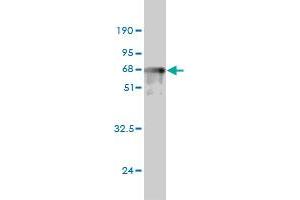 Western Blotting (WB) image for anti-Protein Kinase, AMP-Activated, beta 1 Non-Catalytic Subunit (PRKAB1) (AA 1-270) antibody (ABIN562362)