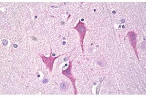 Anti-PKC Mu antibody IHC staining of human brain, cortex neurons. (PKC mu antibody  (AA 171-220))