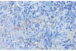 Immunohistochemistry of paraffin-embedded Rat spleen using CR2 Polyclonal Antibody at dilution of 1:100 (40x lens). (CD21 antibody)