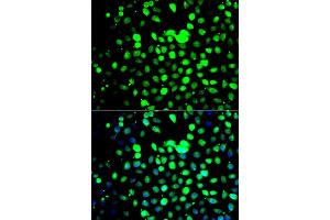 Immunofluorescence analysis of A549 cells using ZBTB25 antibody (ABIN5975302). (ZBTB25 antibody)