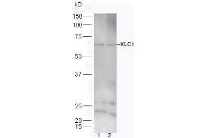 Lane 1: Hela lysates Lane 2:293T lysates probed with Rabbit Anti-KLC1/KNS2 Polyclonal Antibody, Unconjugated (ABIN1385823) at 1:300 overnight at 4 °C.