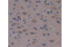 Figure. (MTAP antibody  (AA 6-275))