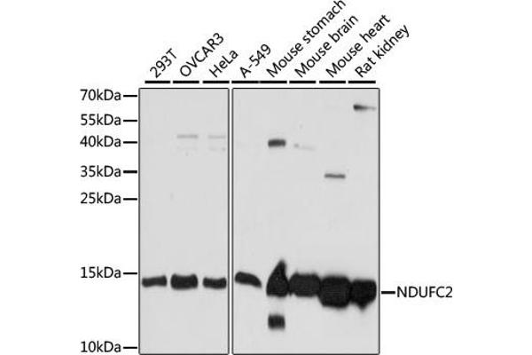 NDUFC2 抗体  (AA 1-100)