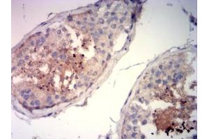 Immunohistochemical analysis of paraffin-embedded testi tissue using SP10 mouse mAb with DAB staining. (ACRV1 antibody  (AA 22-265))