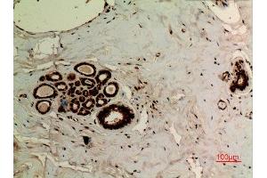 Immunohistochemistry (IHC) analysis of paraffin-embedded Human Breast, antibody was diluted at 1:100. (Ubiquitin antibody  (acLys27))