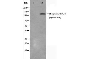 Western blot analysis on HepG2 cell lysate using Phospho-EPHA2/3(Tyr588/596) Antibody,The lane on the left is treated with the antigen-specific peptide. (EPHA2/3/4 antibody  (pTyr588, pTyr596))
