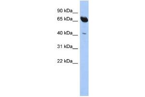 WB Suggested Anti-SCFD1 Antibody Titration: 0. (SCFD1 antibody  (N-Term))