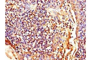 Immunohistochemistry of paraffin-embedded human tonsil tissue using ABIN7158656 at dilution of 1:100 (LEF1 antibody  (AA 75-216))