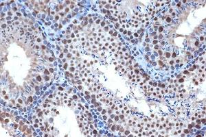 Immunohistochemistry of paraffin-embedded mouse testis using BUB3 Rabbit mAb (ABIN7265960) at dilution of 1:100 (40x lens). (BUB3 antibody)